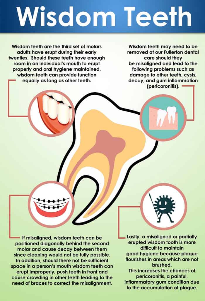 wisom tooth infographic